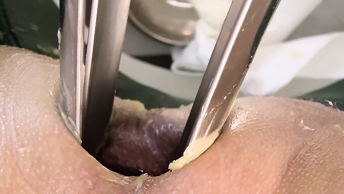 Doctor Fucks Nurse With A Massive Speculum And Double Fisting